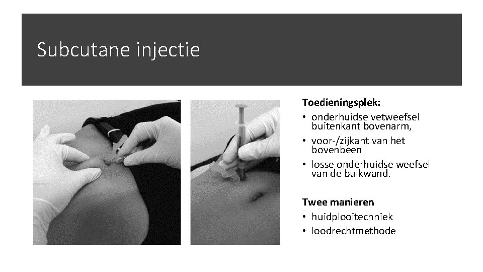Subcutane injectie Toedieningsplek: • onderhuidse vetweefsel buitenkant bovenarm, • voor-/zijkant van het bovenbeen •