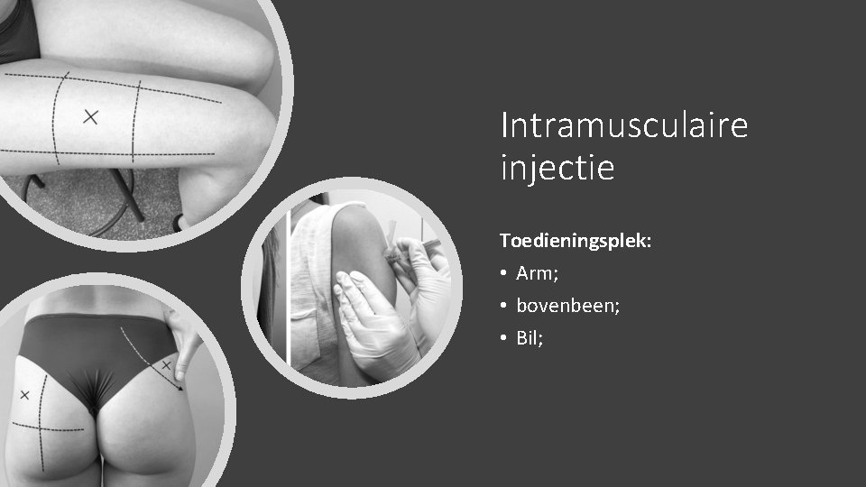 Intramusculaire injectie Toedieningsplek: • Arm; • bovenbeen; • Bil; 