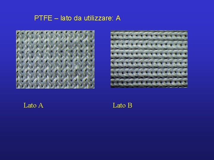 PTFE – lato da utilizzare: A Lato B 