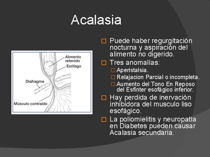 Acalasia Puede haber regurgitación nocturna y aspiración del alimento no digerido. � Tres anomalías: