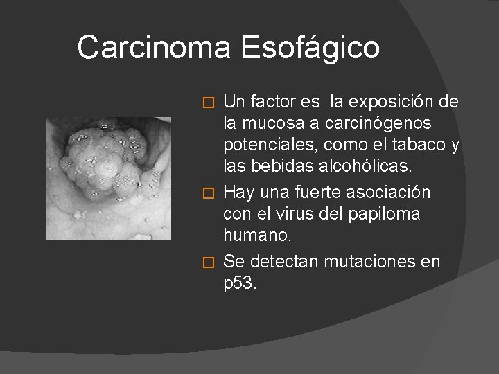Carcinoma Esofágico Un factor es la exposición de la mucosa a carcinógenos potenciales, como