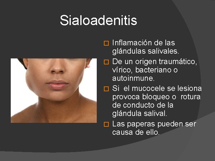 Sialoadenitis Inflamación de las glándulas salivales. � De un origen traumático, vírico, bacteriano o