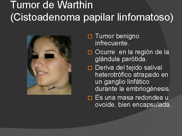 Tumor de Warthin (Cistoadenoma papilar linfomatoso) Tumor benigno infrecuente. � Ocurre en la región