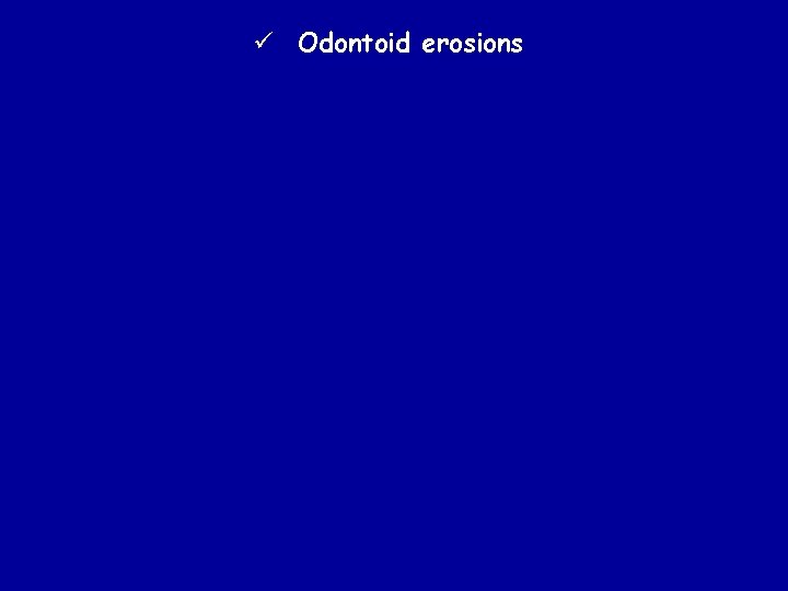ü Odontoid erosions 
