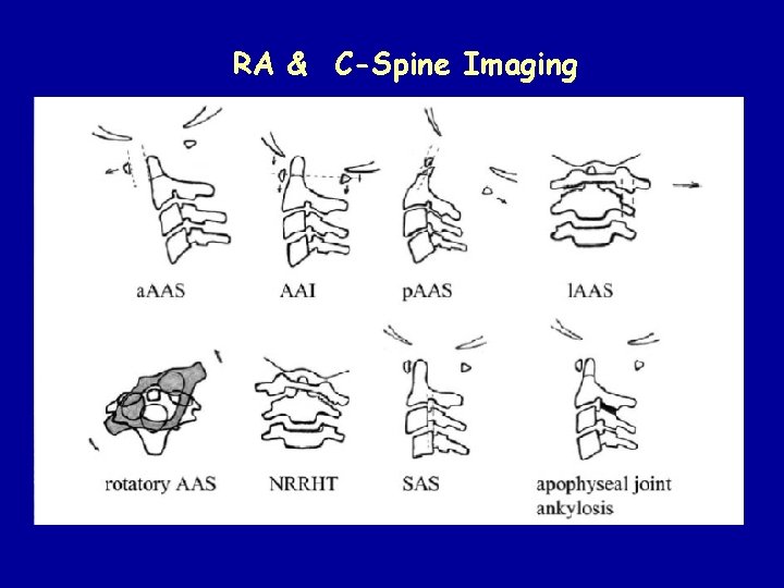 RA & C-Spine Imaging 
