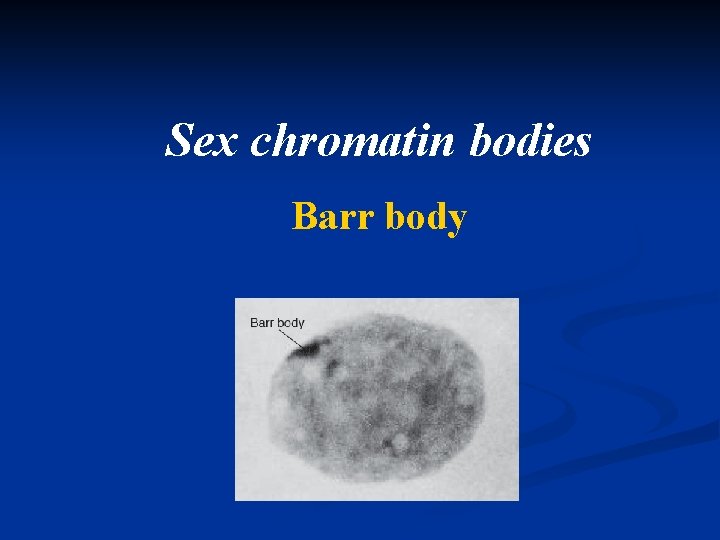 Sex chromatin bodies Barr body 