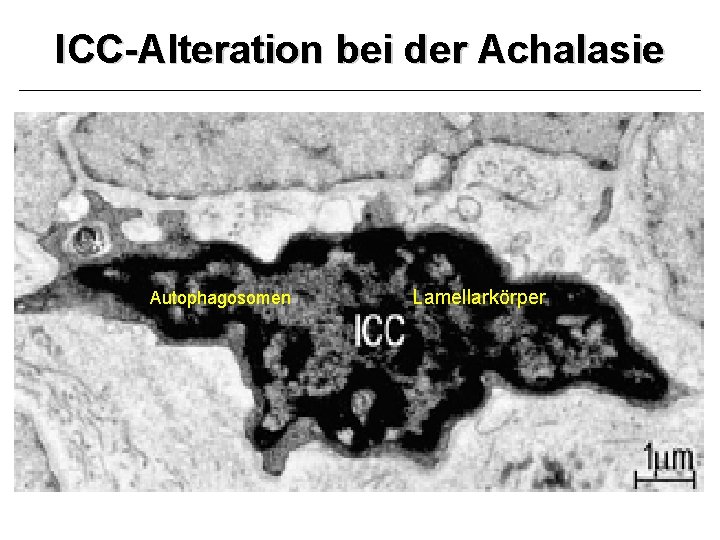 ICC-Alteration bei der Achalasie Autophagosomen Lamellarkörper 