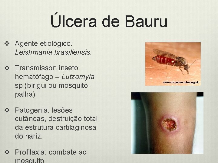 Úlcera de Bauru v Agente etiológico: Leishmania brasiliensis. v Transmissor: inseto hematófago – Lutzomyia