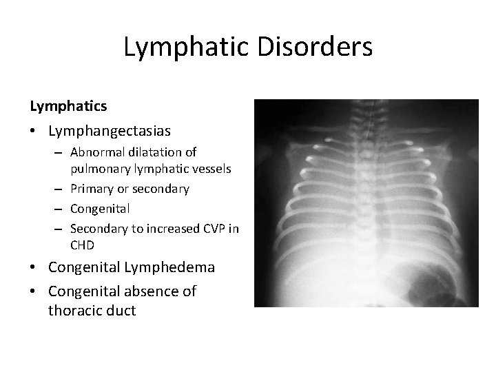 Lymphatic Disorders Lymphatics • Lymphangectasias – Abnormal dilatation of pulmonary lymphatic vessels – Primary