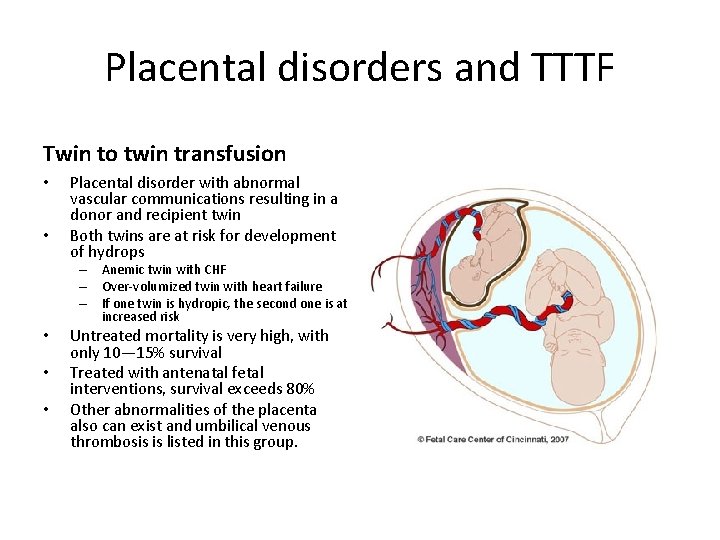 Placental disorders and TTTF Twin to twin transfusion • • Placental disorder with abnormal