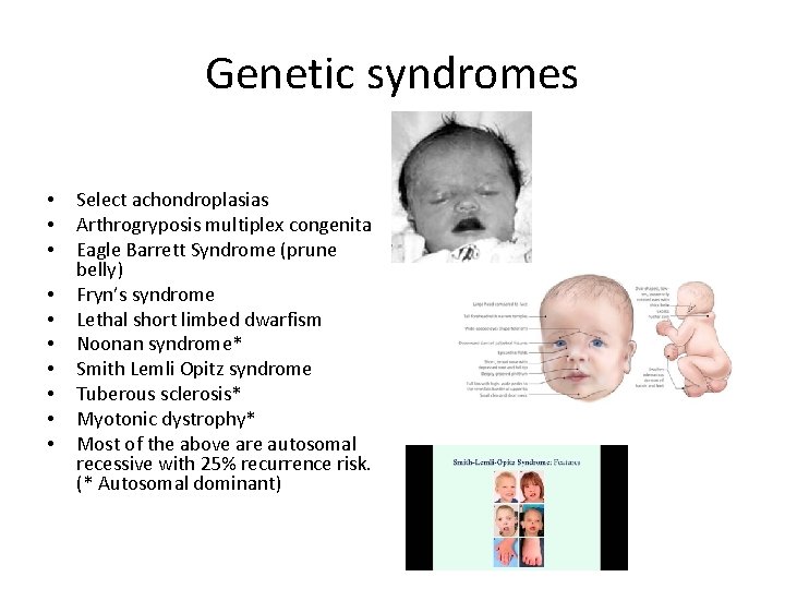 Genetic syndromes • • • Select achondroplasias Arthrogryposis multiplex congenita Eagle Barrett Syndrome (prune