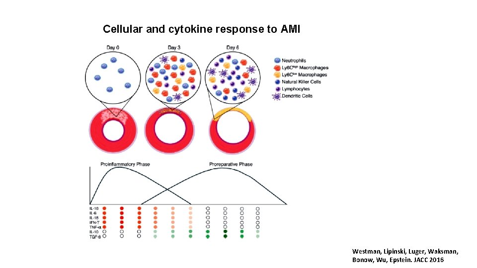 Cellular and cytokine response to AMI Westman, Lipinski, Luger, Waksman, Bonow, Wu, Epstein. JACC