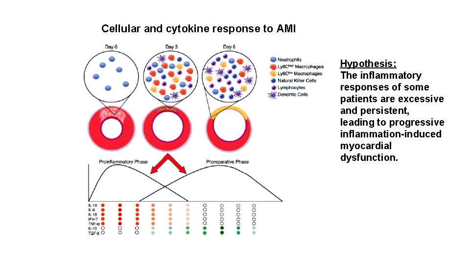 Cellular and cytokine response to AMI Hypothesis: The inflammatory responses of some patients are
