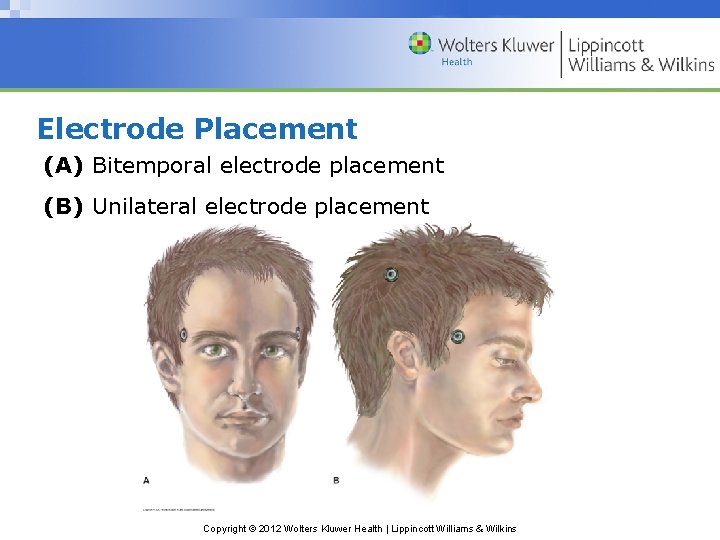 Electrode Placement (A) Bitemporal electrode placement (B) Unilateral electrode placement Copyright © 2012 Wolters