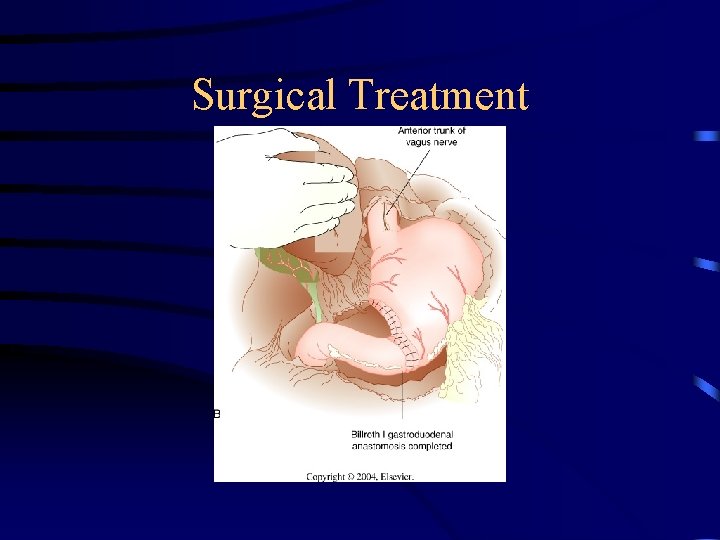 Surgical Treatment 