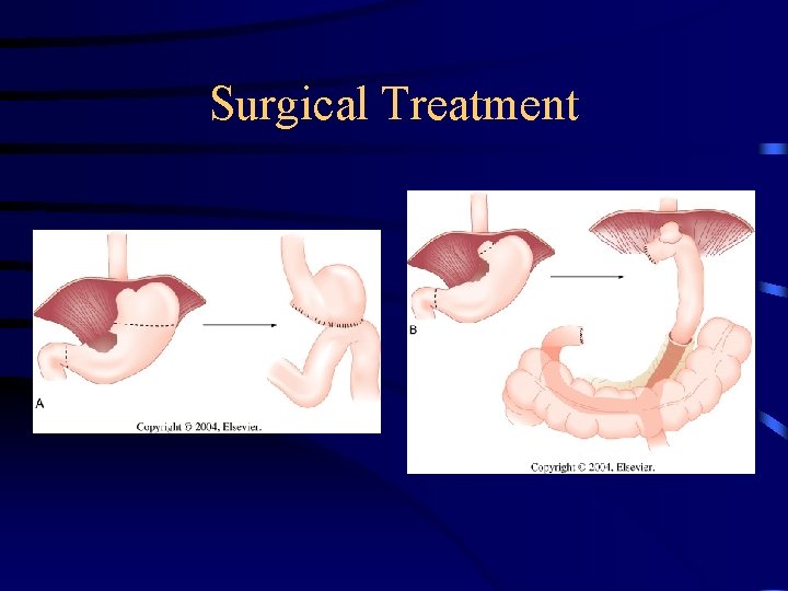 Surgical Treatment 