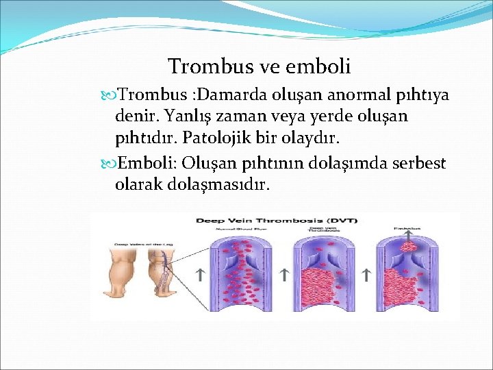 Trombus ve emboli Trombus : Damarda oluşan anormal pıhtıya denir. Yanlış zaman veya yerde