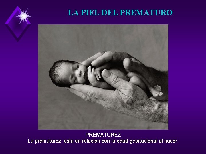 LA PIEL DEL PREMATURO PREMATUREZ La prematurez esta en relación con la edad gesrtacional