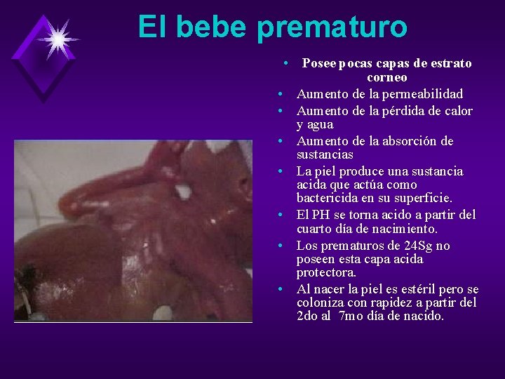 El bebe prematuro • Posee pocas capas de estrato corneo • Aumento de la