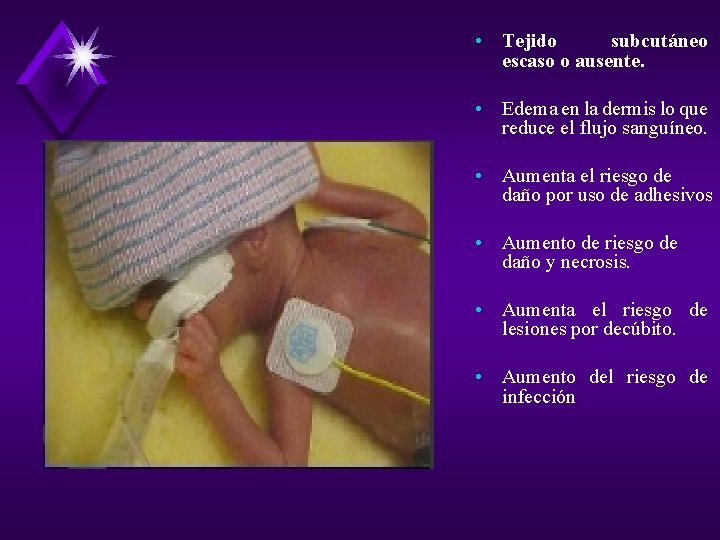  • Tejido subcutáneo escaso o ausente. • Edema en la dermis lo que