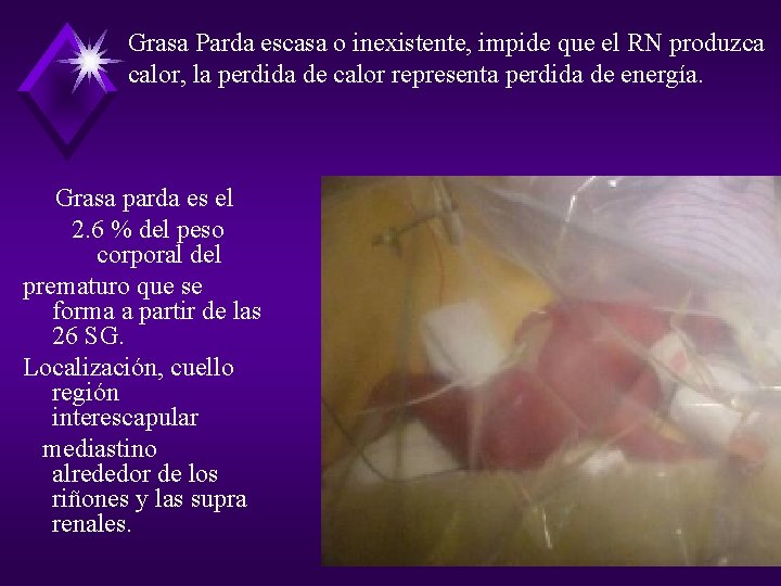 Grasa Parda escasa o inexistente, impide que el RN produzca calor, la perdida de