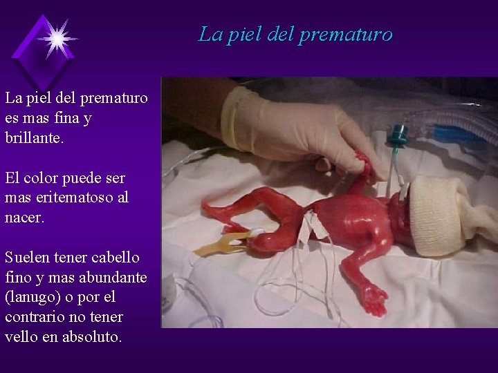 La piel del prematuro es mas fina y brillante. El color puede ser mas