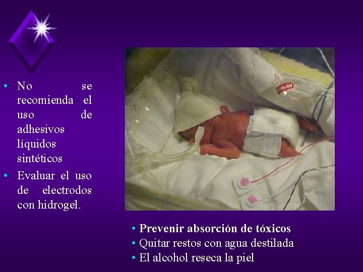 • No se recomienda el uso de adhesivos líquidos sintéticos • Evaluar el