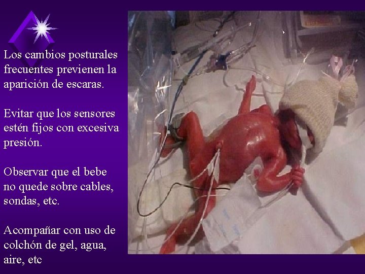 Los cambios posturales frecuentes previenen la aparición de escaras. Evitar que los sensores estén