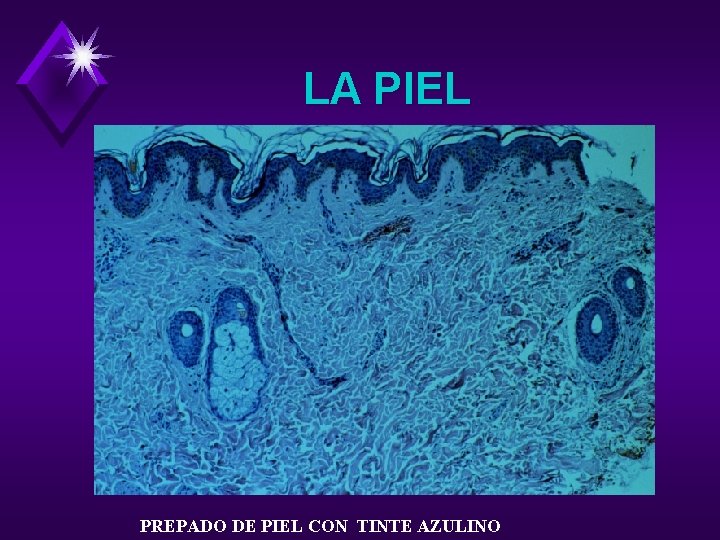 LA PIEL PREPADO DE PIEL CON TINTE AZULINO 