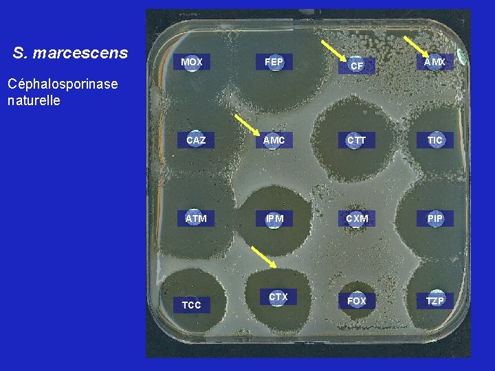 S. marcescens MOX FEP CF AMX CAZ AMC CTT TIC ATM IPM CXM PIP