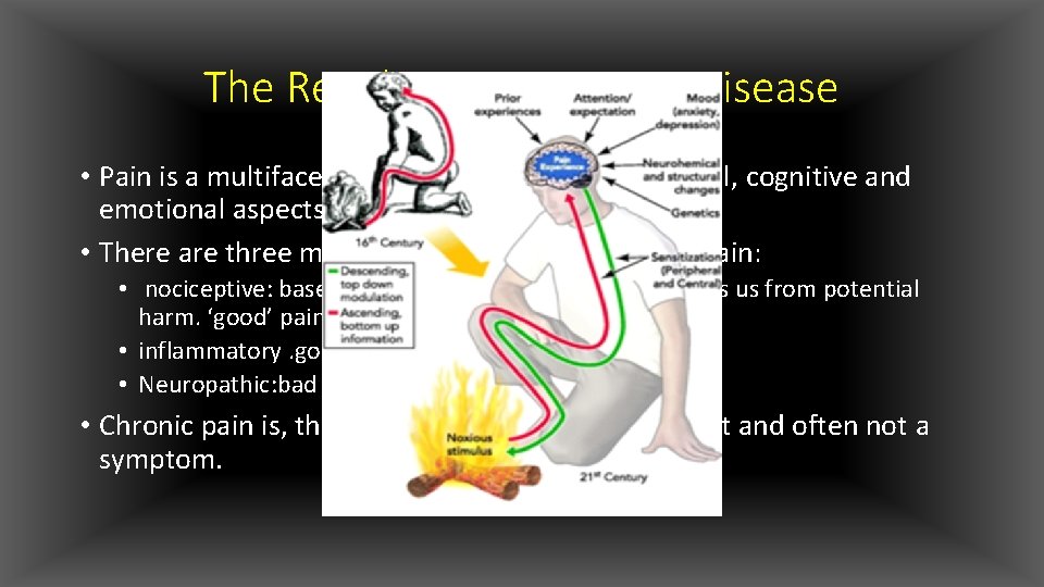 The Revolution: Pain as a Disease • Pain is a multifaceted experience involving physical,