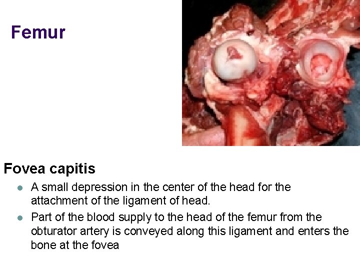 Femur Fovea capitis l l A small depression in the center of the head