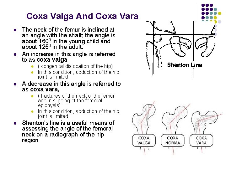Coxa Valga And Coxa Vara l l The neck of the femur is inclined