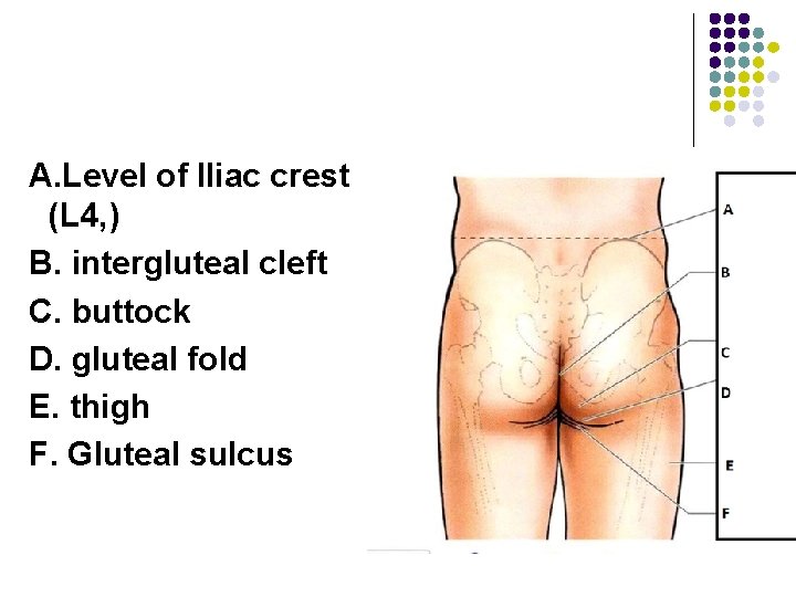 A. Level of Iliac crest (L 4, ) B. intergluteal cleft C. buttock D.