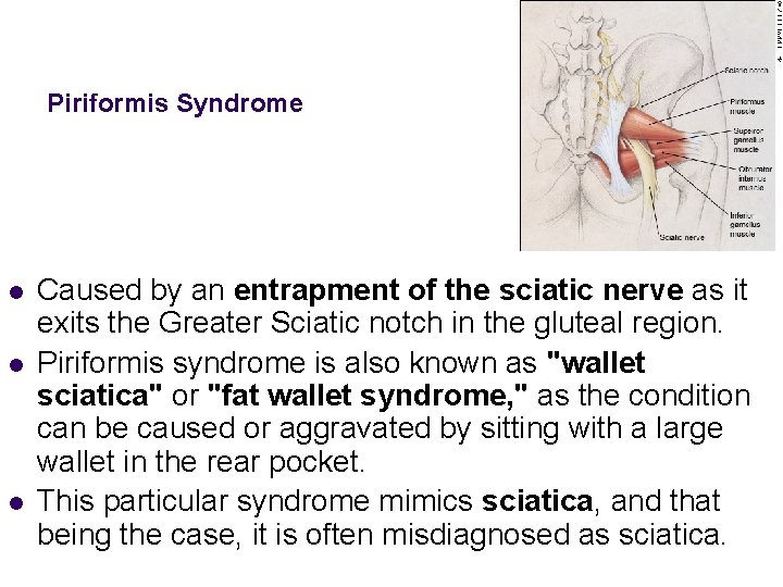 Piriformis Syndrome l l l Caused by an entrapment of the sciatic nerve as
