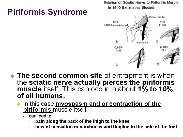 Piriformis Syndrome l The second common site of entrapment is when the sciatic nerve