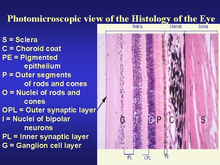 Photomicroscopic view of the Histology of the Eye S = Sclera C = Choroid