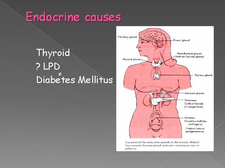 Endocrine causes Thyroid ? LPD e Diabetes Mellitus 