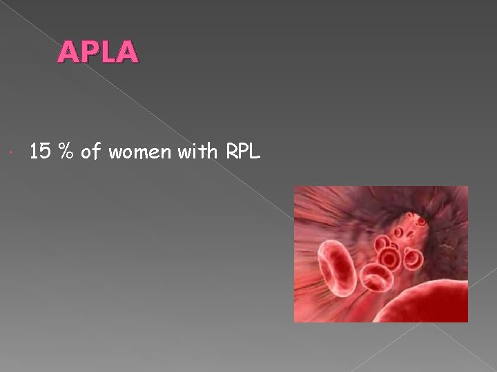 APLA 15 % of women with RPL 