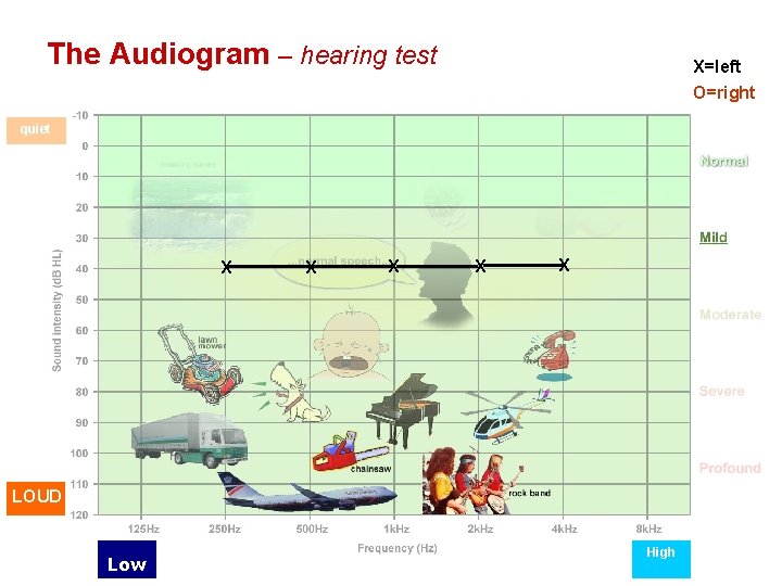 The Audiogram – hearing test X=left O=right quiet X X X LOUD Low High