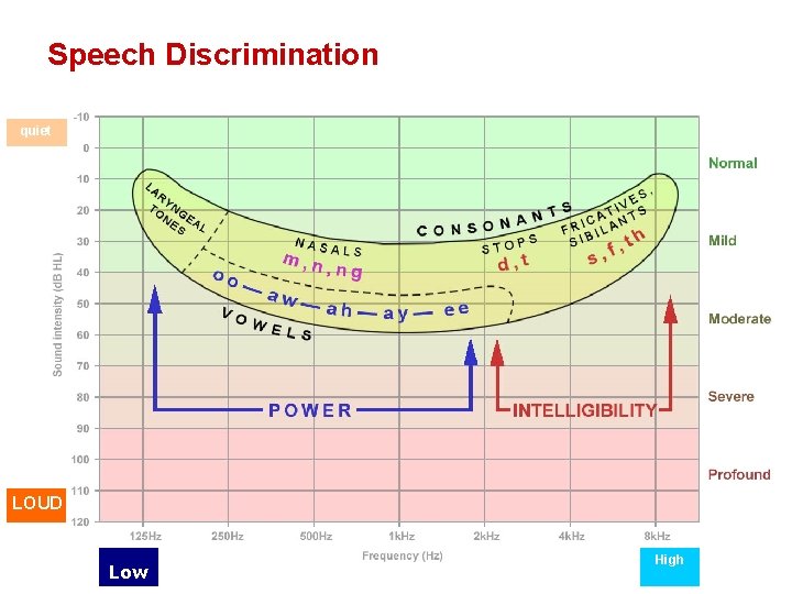 Speech Discrimination quiet LOUD Low High 