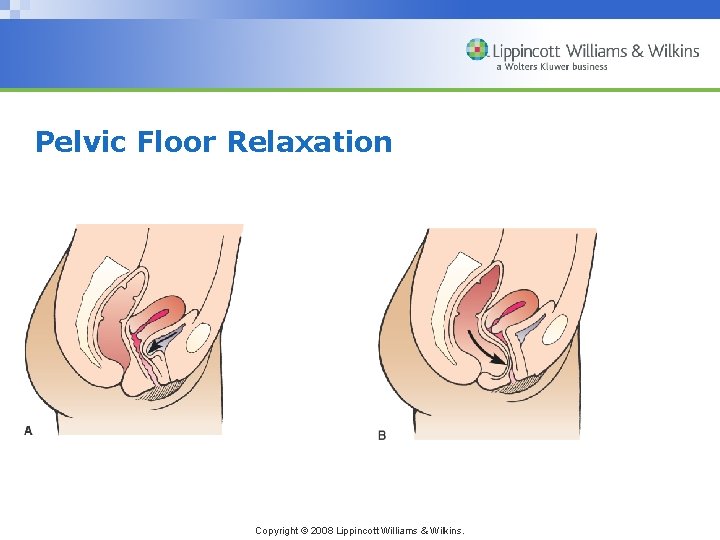 Pelvic Floor Relaxation Copyright © 2008 Lippincott Williams & Wilkins. 
