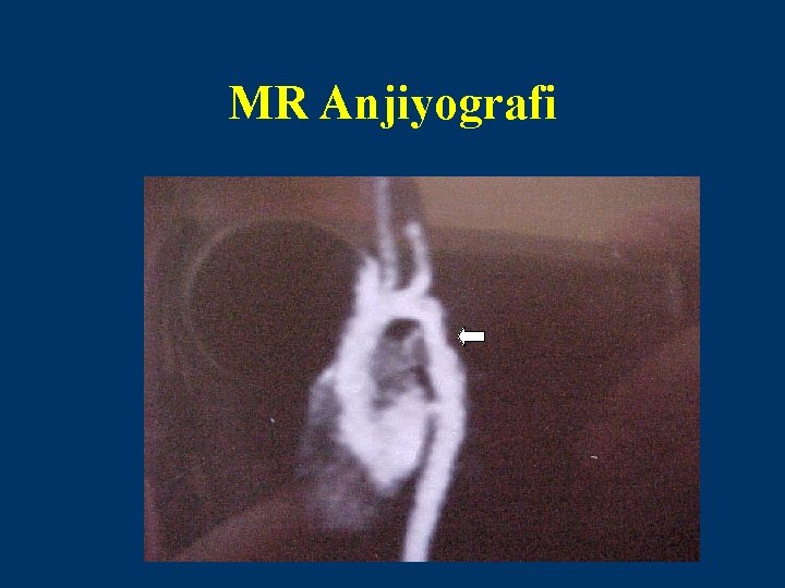 MR Anjiyografi 