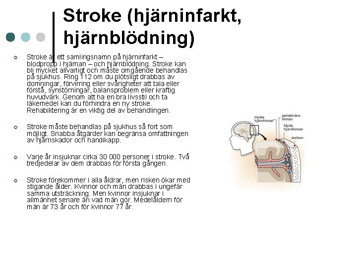 Stroke (hjärninfarkt, hjärnblödning) ¢ Stroke är ett samlingsnamn på hjärninfarkt – blodpropp i hjärnan