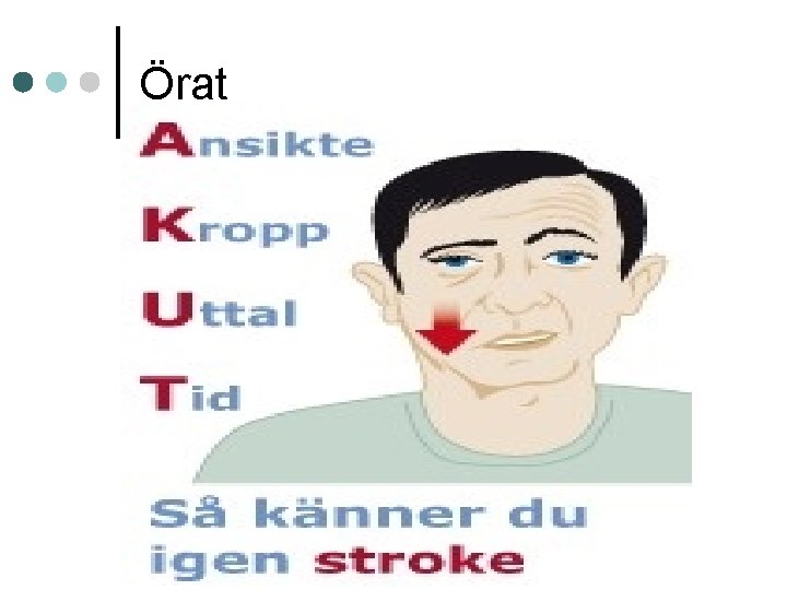 Örat 