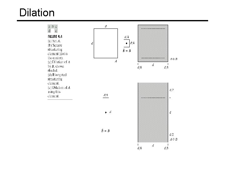 Dilation 