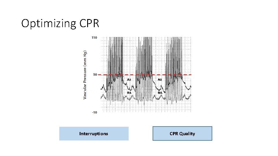 Optimizing CPR Interruptions CPR Quality 