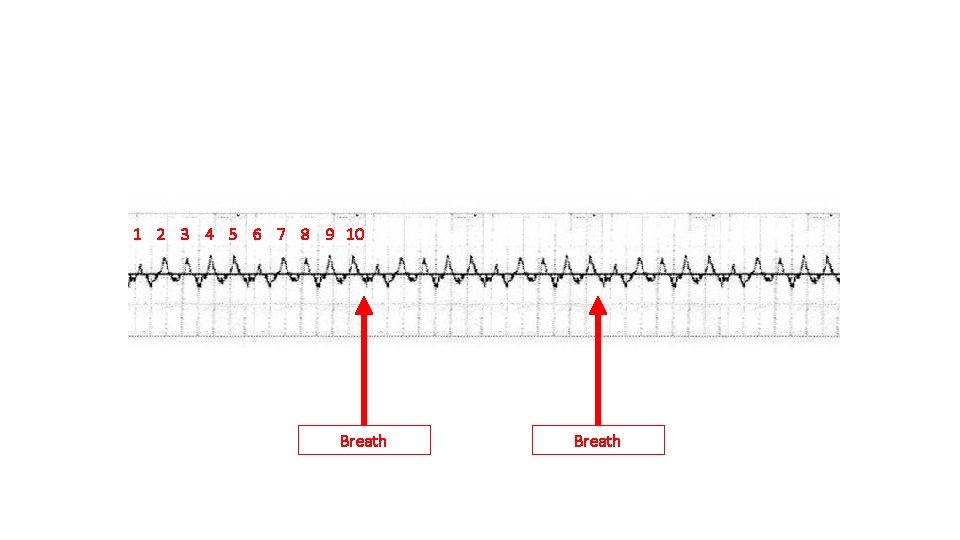 Upstroke Ventilation 1 2 3 4 5 6 7 8 9 10 Breath 