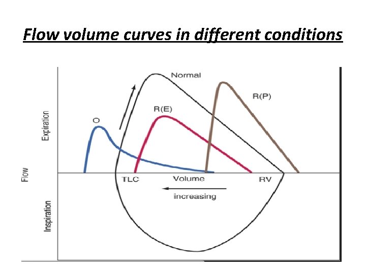 Flow volume curves in different conditions 