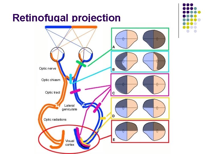 Retinofugal projection 